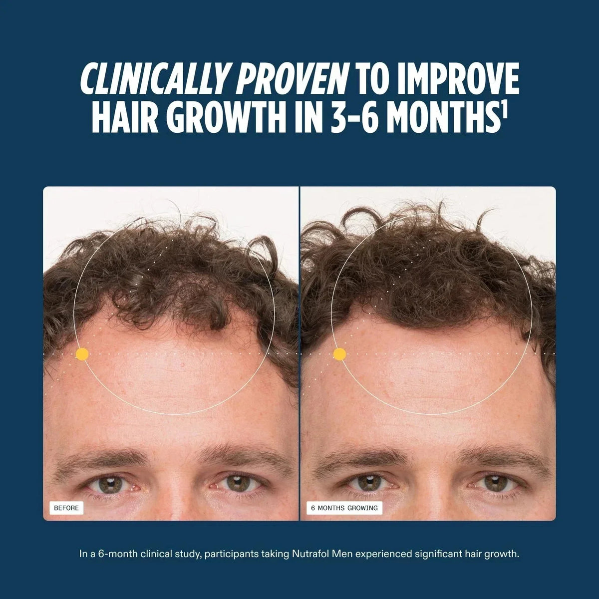 Nutrafol Men's Hair Growth Supplement 120 Capsules
