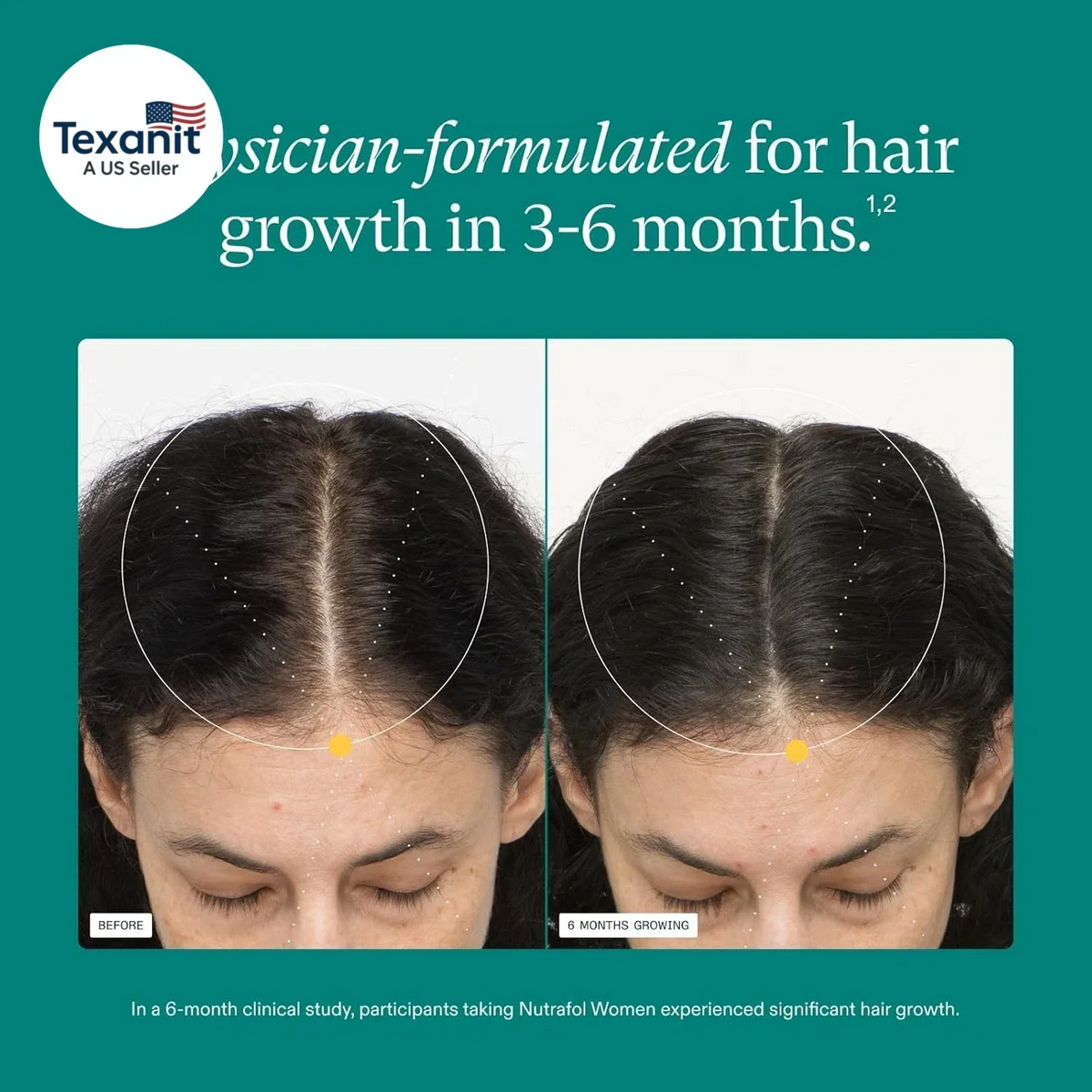 Women's Hair Growth Supplement 360 Capsules